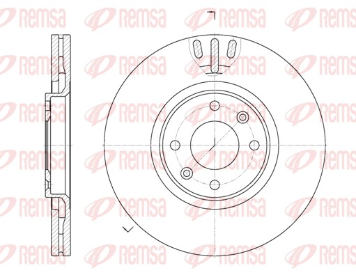 Disque de frein REMSA 6657.10